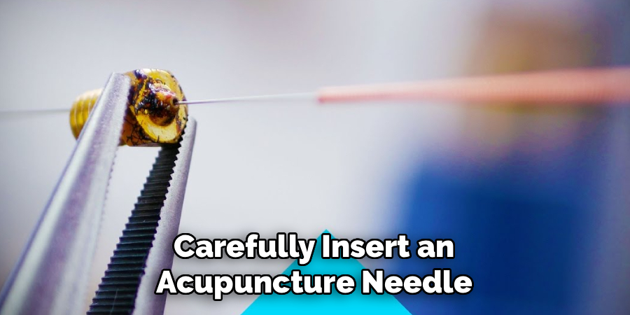Carefully Insert an Acupuncture Needle